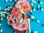 The toxins present within plastics can cause additional complications to the kidneys for individuals with existing kidney diseases. 