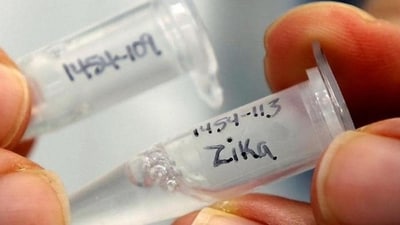 In June PMC has reported five Zika virus infection cases, including a 28-year-old pregnant woman from Erandwane. (REPRESENTATIVE PHOTO) In June PMC has reported five Zika virus infection cases, including a 28-year-old pregnant woman from Erandwane. (REPRESENTATIVE PHOTO)