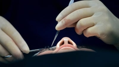 At least 25 patients started experiencing complications following cataract surgeries at a West Bengal government-run hospital in Kolkata's Metiabruz (AFP / Relevant Image )