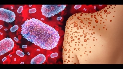 There are 22 labs for Mpox in India and there are 13 buffer labs, with PGIMER, Chandigarh, being one of them. (Shutterstock) There are 22 labs for Mpox in India and there are 13 buffer labs, with PGIMER, Chandigarh, being one of them. (Shutterstock)