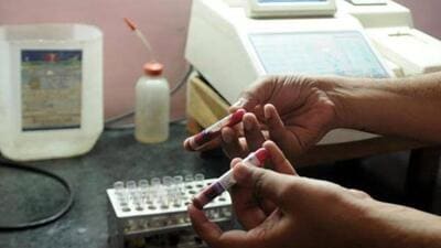 There are around 150-200 private diagnostic labs in Gautam Budh Nagar district — around 100 in Noida, 30-40 labs in Greater Noida and remaining in other parts of the district. (HT Archives) There are around 150-200 private diagnostic labs in Gautam Budh Nagar district — around 100 in Noida, 30-40 labs in Greater Noida and remaining in other parts of the district. (HT Archives)