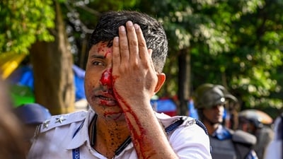 A policeman who got injured after violence broke out during a protest march of students towards West Bengal Secretariat over the alleged sexual assault and murder of a trainee doctor, in Kolkata, Tuesday, Aug. 27. (PTI) A policeman who got injured after violence broke out during a protest march of students towards West Bengal Secretariat over the alleged sexual assault and murder of a trainee doctor, in Kolkata, Tuesday, Aug. 27. (PTI)