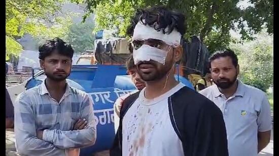 Suraj, 24, who was attacked with rods and a sword in Sector 56, Chandigarh, on Friday night. (HT Photo)