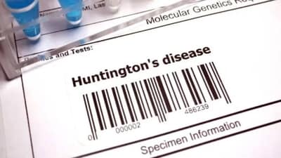 Huntington's Disease is an incurable inherited neurological illness. (Unsplash) Huntington's Disease is an incurable inherited neurological illness. (Unsplash)