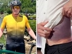 Gordon Ramsay's bike spun 180 degrees following the jolt, tossing him from his two-wheeler. Gordon Ramsay's bike spun 180 degrees following the jolt, tossing him from his two-wheeler.