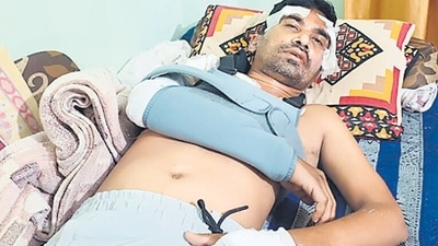 Yogesh Gaikwad, 43, a freelance driver, serious physical wounds last month. Yogesh Gaikwad, 43, a freelance driver, serious physical wounds last month.