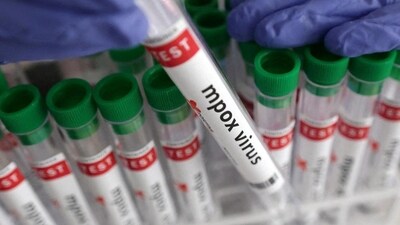 Mpox or monkey pox is an infectious viral disease.It can be serious and even fatal in some cases. (Reuters) Mpox or monkey pox is an infectious viral disease.It can be serious and even fatal in some cases. (Reuters)