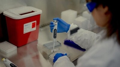 While vaccine-induced antibodies typically targeted a small portion of the spike protein of the virus (which directly attaches to human cells), antibodies in those with hybrid immunity tended to target that spike protein more broadly. (Bloomberg) While vaccine-induced antibodies typically targeted a small portion of the spike protein of the virus (which directly attaches to human cells), antibodies in those with hybrid immunity tended to target that spike protein more broadly. (Bloomberg)