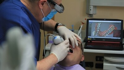 China: The doctor employed the "immediate restoration" method, which involved extracting 23 teeth and placing 12 implants in a single treatment. (Unsplash) China: The doctor employed the "immediate restoration" method, which involved extracting 23 teeth and placing 12 implants in a single treatment. (Unsplash)