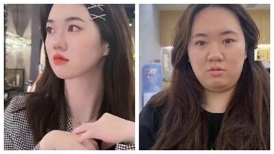 Overwork obesity involves rapid weight gain due to stress. Before and After pics of the Chinese woman who suffered from overwork obesity. (South China Morning Post) Overwork obesity involves rapid weight gain due to stress. Before and After pics of the Chinese woman who suffered from overwork obesity. (South China Morning Post)