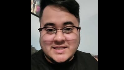 The US man explained how he discovered the Lego piece in his nose. (Instagram) The US man explained how he discovered the Lego piece in his nose. (Instagram)