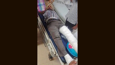 Mohali police ASI Jagdev Singh suffered fractures in both legs in the incident. (HT Photo)