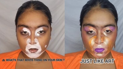 The woman faced backlash for pretending to have vitiligo for a makeup video.