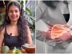 Deepsikha Jain, a nutritionist, uggested the use of four superfoods that can help in combatting fatty liver diseases.
