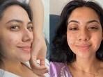 Actor Reem Sameer Shaikh endured facial burns while shooting for Laughter Chefs. Actor Reem Sameer Shaikh endured facial burns while shooting for Laughter Chefs.