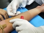 Researchers at King's College London develop a blood test to identify children at risk of obesity-related disorders,