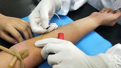 Researchers at King's College London develop a blood test to identify children at risk of obesity-related disorders, Researchers at King's College London develop a blood test to identify children at risk of obesity-related disorders,