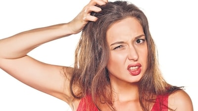 Dandruff shampoo not working? It could be scalp psoriasis! Know clear signs (For representational purposes only) Dandruff shampoo not working? It could be scalp psoriasis! Know clear signs (For representational purposes only)