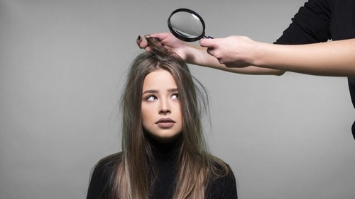 What are you doing to keep your hair dandruff free? (Shutterstock) What are you doing to keep your hair dandruff free? (Shutterstock)