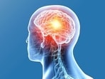 Scientists discover antidepressant Vortioxetine may combat incurable brain tumour.
