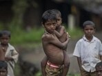 Children suffering from malnutrition (HT FILE)