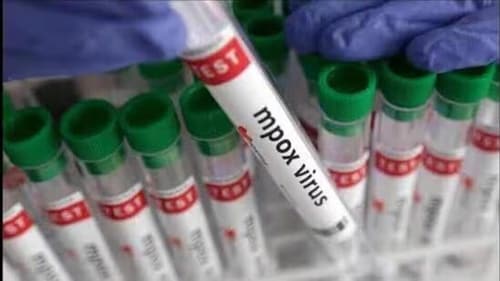 Mpox is a viral disease caused by the monkeypox virus. (HT_PRINT/Representational image) Mpox is a viral disease caused by the monkeypox virus. (HT_PRINT/Representational image)