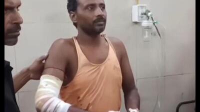 Madhusoodan being treated at Bahraich Medical College after being attacked by a leopard (HT Photo) Madhusoodan being treated at Bahraich Medical College after being attacked by a leopard (HT Photo)