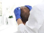 A "salon stroke" can occur suddenly due to neck manipulation or massage, leading to reduced blood flow to the brain.
