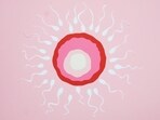 Male infertility likely involves issues with sperm quality, Male infertility likely involves issues with sperm quality,