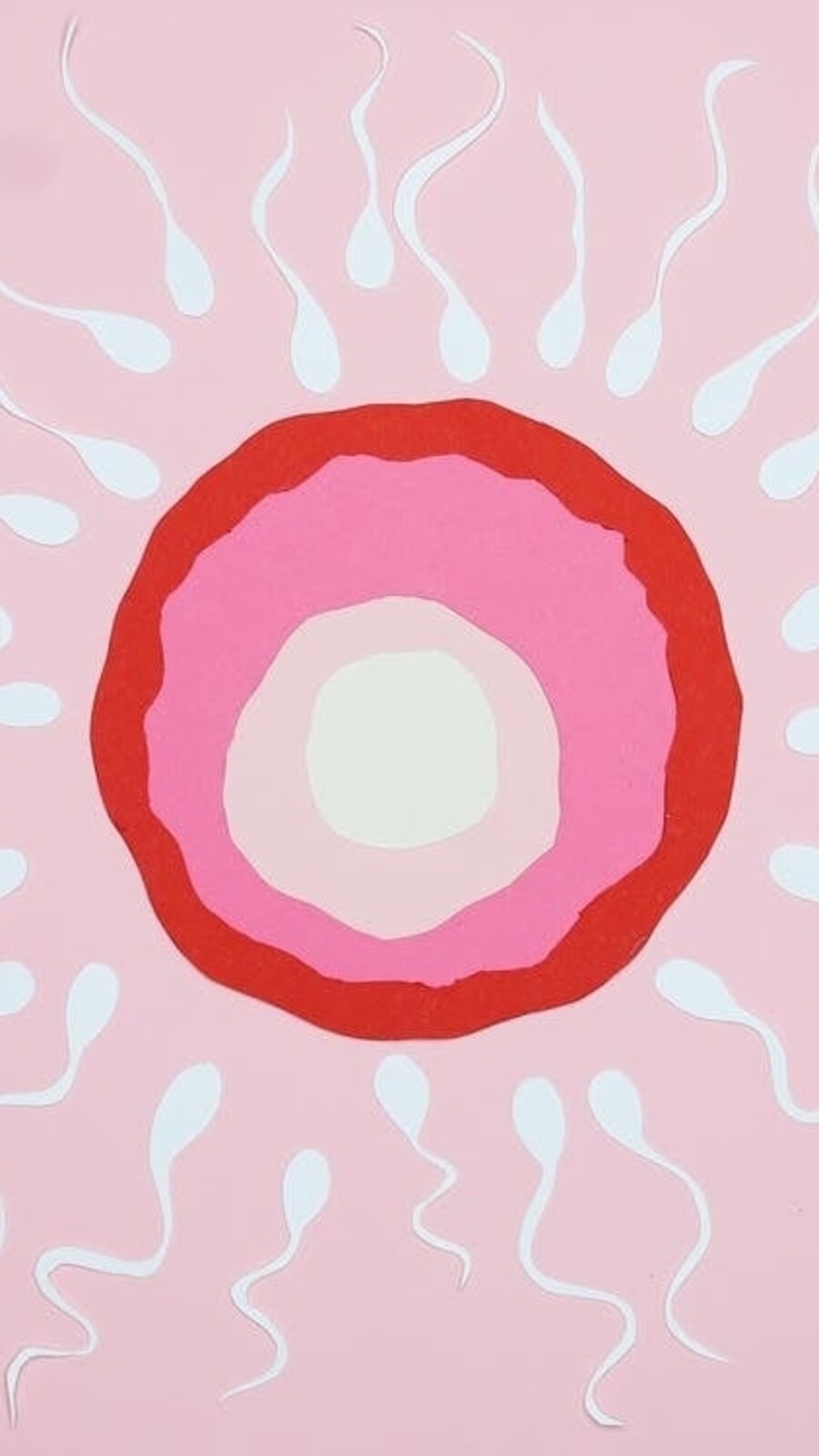 Male infertility likely involves issues with sperm quality, (Pexels)