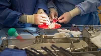 The eight-member gang who conducted illegal transplants across five states - Delhi, Punjab, Haryana, Madhya Pradesh and Gujarat - worked in different hospitals in various positions (AP Photo/Molly Riley, File) (AP) The eight-member gang who conducted illegal transplants across five states - Delhi, Punjab, Haryana, Madhya Pradesh and Gujarat - worked in different hospitals in various positions (AP Photo/Molly Riley, File) (AP)