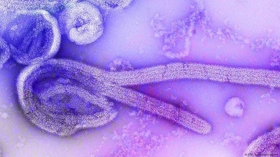 The Marburg pathogen is one of the most dangerous known pathogens. (CDC/dpa/picture alliance ) The Marburg pathogen is one of the most dangerous known pathogens. (CDC/dpa/picture alliance )