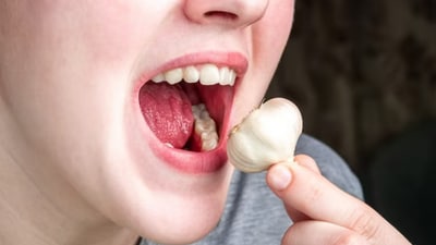 While garlic has antibacterial properties, experts emphasise that it's not a proven acne cure. (Freepik) While garlic has antibacterial properties, experts emphasise that it's not a proven acne cure. (Freepik)