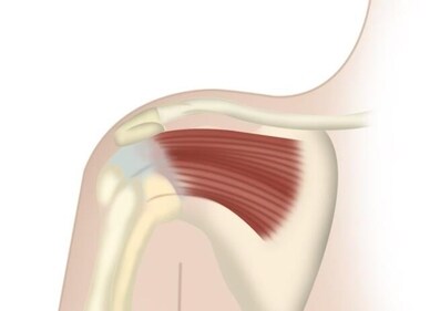 Corticosteroid or hyaluronic acid injections reduce inflammation and provide temporary relief. (Ilustration: Mitrarun Haldar)