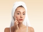 closeup-young-woman-with-towel-head-pimples-face_2_1664368575540