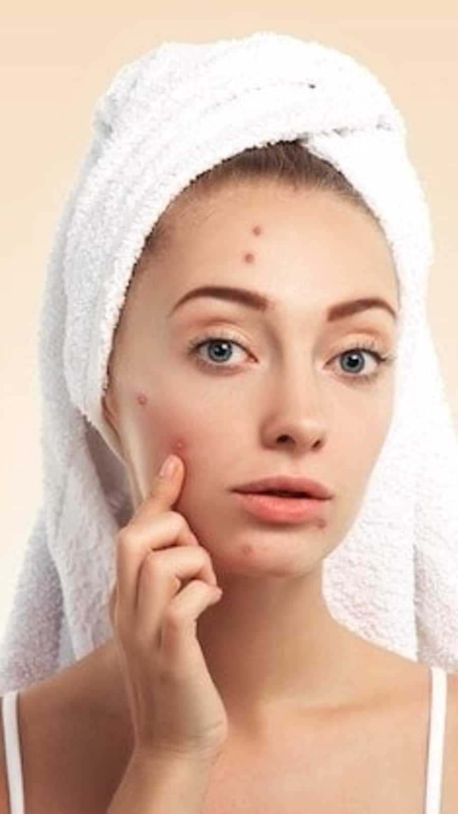 closeup-young-woman-with-towel-head-pimples-face_2_1664368575540