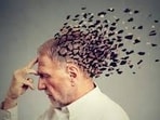 Dementia alters a person's behaviour. Dementia alters a person's behaviour.