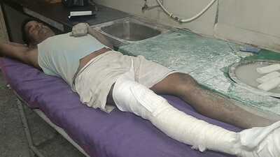 An injured labourer being treated at the civil hospital in Sector 6, Panchkula, on Tuesday. (HT photo)