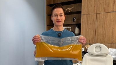 Bryan Johnson bragged about his 'super clean' plasma in an X post (X/@bryan_johnson) Bryan Johnson bragged about his 'super clean' plasma in an X post (X/@bryan_johnson)