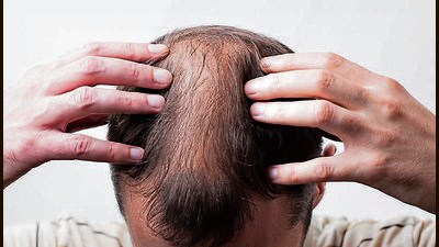 Men start looking like dilapidated versions of their own selves, and cannot hope to live in perpetual avoidance of the stark reality. Women somehow manage to put their best foot forward and escape the older look for as long as possible. (Shutterstock)