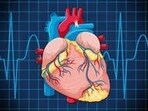 Adults with congenital heart disease (CHD) can now gain vital insights into their long-term quality of life. Adults with congenital heart disease (CHD) can now gain vital insights into their long-term quality of life.
