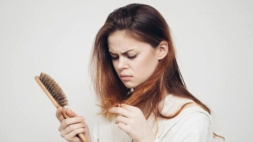 Protein deficiency can make you hair look dull and its roots weak. If you are having hair fall issues, you must ensure adequate protein consumption. (Shutterstock) Protein deficiency can make you hair look dull and its roots weak. If you are having hair fall issues, you must ensure adequate protein consumption. (Shutterstock)