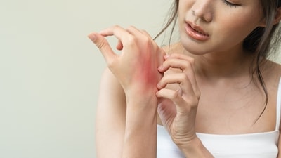 It is not just about itchy skin: Know surprising truth about Atopic Dermatitis as Eczema is on the rise in India (Photo by Shutterstock) It is not just about itchy skin: Know surprising truth about Atopic Dermatitis as Eczema is on the rise in India (Photo by Shutterstock)