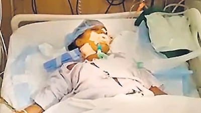 10-year-old girl lands in ICU after teacher slaps her under ear 10-year-old girl lands in ICU after teacher slaps her under ear