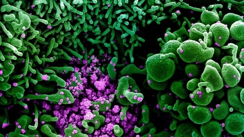 Those not vaccinated against Covid may also suffer from cancer, diabetes and respiratory failure. (Photo via REUTERS) Those not vaccinated against Covid may also suffer from cancer, diabetes and respiratory failure. (Photo via REUTERS)