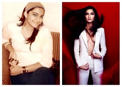 Sonam Kapoor before and after. Sonam Kapoor before and after.