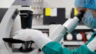 A scientist examines COVID-19 infected cells under a microscope. A scientist examines COVID-19 infected cells under a microscope.