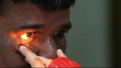 A doctor checks the eyes of a patient before a cataract surgery. (HT File Photo) A doctor checks the eyes of a patient before a cataract surgery. (HT File Photo)