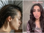 Dermatologist explains why sleeping with wet hair can cause fungal infection. Dermatologist explains why sleeping with wet hair can cause fungal infection.