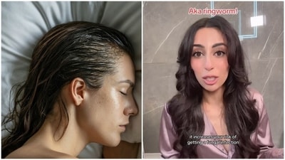 Dermatologist explains why sleeping with wet hair can cause fungal infection. Dermatologist explains why sleeping with wet hair can cause fungal infection.